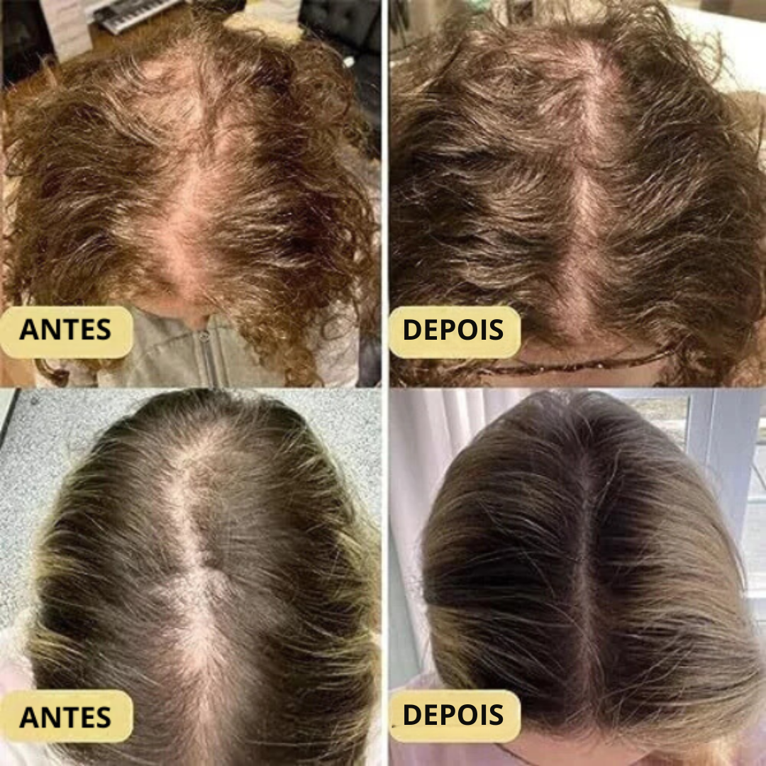 Revitalize o Seu Cabelo: Óleo Vegano Natural para Crescimento Capilar